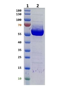 Lane 1: MW marker (PageRuler Prestained Protein Ladder 10-180 kDa) <br />Lane 2: RTRXR2